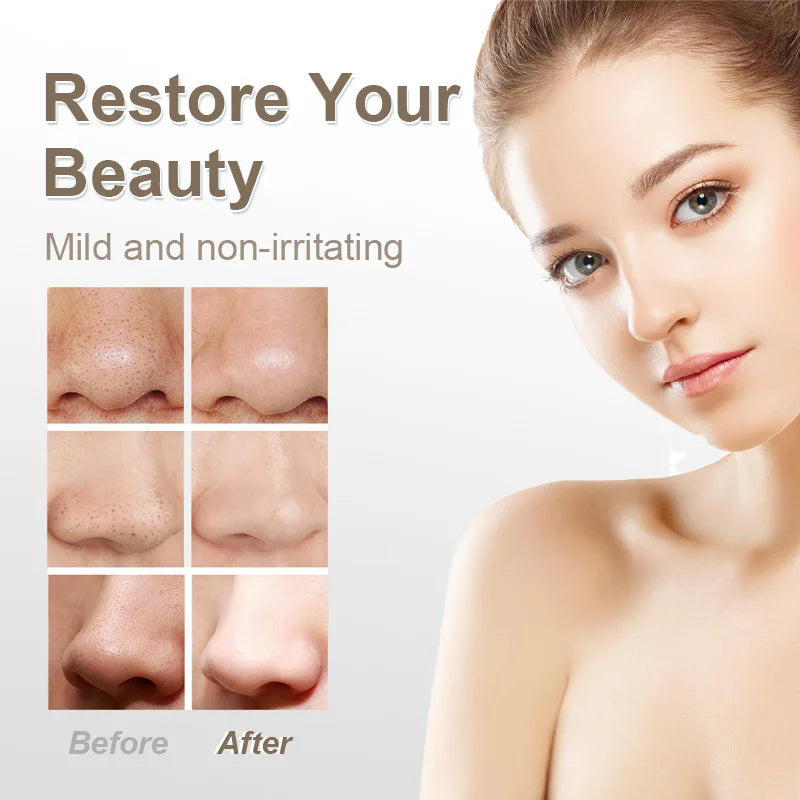 Electric Blackhead Suction Device Acne Treatment Home Beauty Device Pore Cleanser Beauty Device Derive